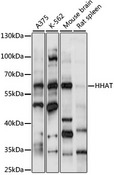 Skn / HHAT Antibody - Western blot analysis of extracts of various cell lines, using HHAT antibody at 1:1000 dilution. The secondary antibody used was an HRP Goat Anti-Rabbit IgG (H+L) at 1:10000 dilution. Lysates were loaded 25ug per lane and 3% nonfat dry milk in TBST was used for blocking. An ECL Kit was used for detection and the exposure time was 60s.