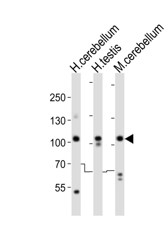 SKOR2 Antibody - Western blot of lysates from human cerebellum, human testis, mouse cerebellum tissue lysate (from left to right), using SKOR2 antibody diluted at 1:1000 at each lane. A goat anti-rabbit IgG H&L (HRP) at 1:10000 dilution was used as the secondary antibody. Lysates at 20 ug per lane.