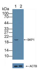 SKP1 Antibody - Knockout Varification: Lane 1: Wild-type Hela cell lysate; Lane 2: SKP1 knockout Hela cell lysate; Predicted MW: 18,19kd Observed MW: 20kd Primary Ab: 2µg/ml Rabbit Anti-Human SKP1 Antibody Second Ab: 0.2µg/mL HRP-Linked Caprine Anti-Rabbit IgG Polyclonal Antibody