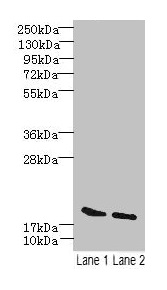 SKP1 Antibody - Western blot All lanes: SKP1 antibody at 15µg/ml Lane 1: Mouse brain tissue Lane 2: Hela whole cell lysate Secondary Goat polyclonal to rabbit IgG at 1/10000 dilution Predicted band size: 19 kDa Observed band size: 19 kDa