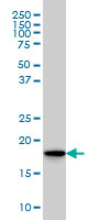 SKP1 Antibody - SKP1A monoclonal antibody (M01), clone 1H8 Western Blot analysis of SKP1A expression in HeLa.