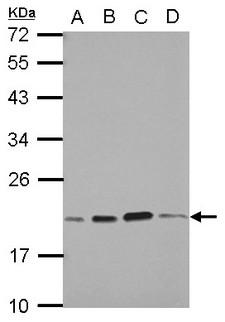 SKP1 Antibody - Sample (30 ug of whole cell lysate) A: A549 B: H1299 C: HCT116 D: MCF-7 12% SDS PAGE SKP1 antibody diluted at 1:1000