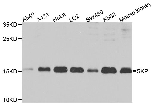 SKP1 Antibody - Western blot analysis of extracts of various cells.