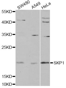 SKP1 Antibody - Western blot analysis of extracts of various cell lines, using SKP1 antibody at 1:1000 dilution. The secondary antibody used was an HRP Goat Anti-Rabbit IgG (H+L) at 1:10000 dilution. Lysates were loaded 25ug per lane and 3% nonfat dry milk in TBST was used for blocking.