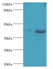 SKP2 Antibody - Western blot. All lanes: SKP2 antibody at 2 ug/ml Lane 1:Jurkat whole cell lysate. Lane 2: HeLa whole cell lysate. Secondary antibody: Goat polyclonal to rabbit at 1:10000 dilution. Predicted band size: 48 kDa. Observed band size: 48 kDa.  This image was taken for the unconjugated form of this product. Other forms have not been tested.