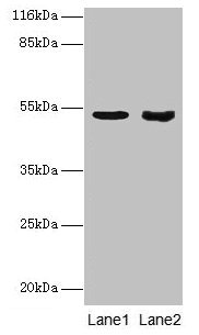 SKP2 Antibody - Western blot All lanes: SKP2 antibody at 2µg/ml Lane 1: Jurkat whole cell lysate Lane 2: Hela whole cell lysate Secondary Goat polyclonal to rabbit IgG at 1/10000 dilution Predicted band size: 48, 47, 24 kDa Observed band size: 48 kDa