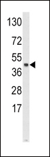 SKP2 Antibody - Western blot of SKP2 Antibody in HeLa cell line lysates (35 ug/lane). SKP2 (arrow) was detected using the purified antibody.