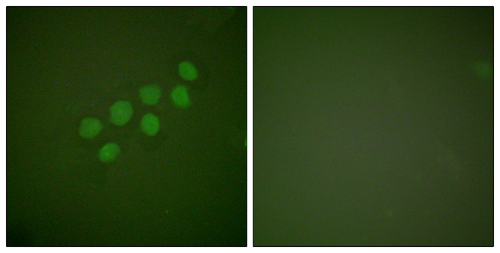 SKP2 Antibody - Immunofluorescence analysis of A549 cells, using SKP2/p45 Antibody. The picture on the right is blocked with the synthesized peptide.