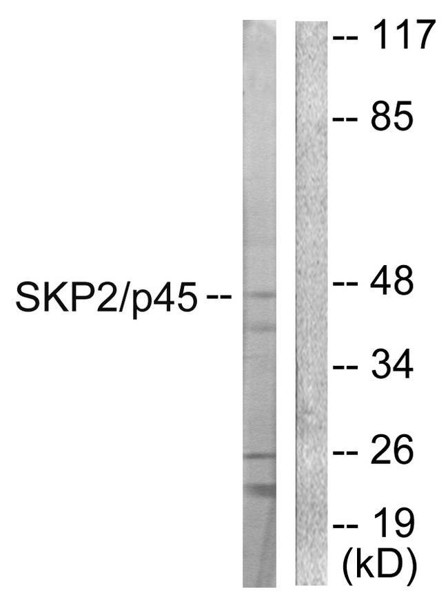 SKP2 Antibody - Western blot analysis of lysates from 293 cells, using SKP2/p45 Antibody. The lane on the right is blocked with the synthesized peptide.