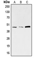 SKP2 Antibody - Western blot analysis of SKP2 expression in A673 (A); HeLa (B); K562 (C) whole cell lysates.