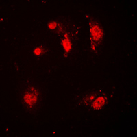 SKP2 Antibody - Immunofluorescent analysis of SKP2 staining in HeLa cells. Formalin-fixed cells were permeabilized with 0.1% Triton X-100 in TBS for 5-10 minutes and blocked with 3% BSA-PBS for 30 minutes at room temperature. Cells were probed with the primary antibody in 3% BSA-PBS and incubated overnight at 4 C in a humidified chamber. Cells were washed with PBST and incubated with a DyLight 594-conjugated secondary antibody (red) in PBS at room temperature in the dark. DAPI was used to stain the cell nuclei (blue).