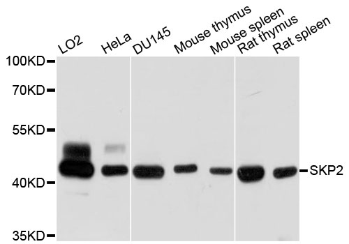 SKP2 Antibody - Western blot analysis of extracts of various cell lines.
