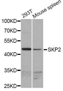 SKP2 Antibody - Western blot analysis of extracts of various cell lines, using SKP2 antibody at 1:1000 dilution. The secondary antibody used was an HRP Goat Anti-Rabbit IgG (H+L) at 1:10000 dilution. Lysates were loaded 25ug per lane and 3% nonfat dry milk in TBST was used for blocking. An ECL Kit was used for detection and the exposure time was 90s.