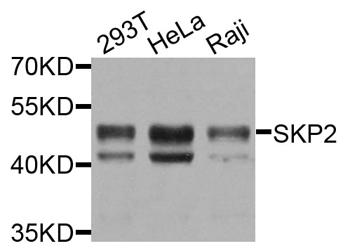 SKP2 Antibody - Western blot blot of extracts of various cells, using SKP2 antibody.