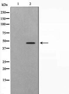 SKP2 Antibody - Western blot analysis on 293 cell lysates using SKP2/p45 antibody. The lane on the left is treated with the antigen-specific peptide.