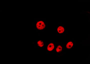 SKP2 Antibody - Staining HeLa cells by IF/ICC. The samples were fixed with PFA and permeabilized in 0.1% Triton X-100, then blocked in 10% serum for 45 min at 25°C. The primary antibody was diluted at 1:200 and incubated with the sample for 1 hour at 37°C. An Alexa Fluor 594 conjugated goat anti-rabbit IgG (H+L) Ab, diluted at 1/600, was used as the secondary antibody.