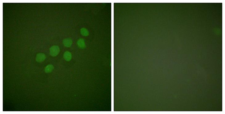 SKP2 Antibody - Peptide - + Immunofluorescence analysis of A549 cells, using SKP2/p45 antibody.