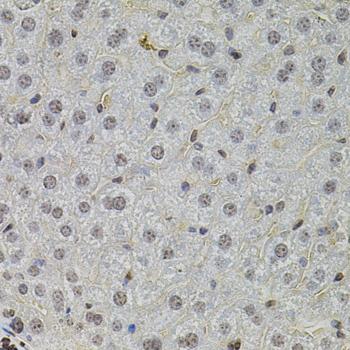 SKP2 Antibody - Immunohistochemistry of paraffin-embedded Mouse liver using SKP2 Polyclonal Antibody at dilution of 1:100 (40x lens).