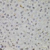 SKP2 Antibody - Immunohistochemistry of paraffin-embedded Mouse liver using SKP2 Polyclonal Antibody at dilution of 1:100 (40x lens).