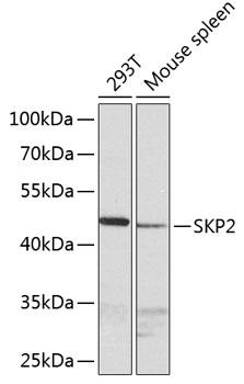 SKP2 Antibody - Western blot analysis of extracts of various cell lines using SKP2 Polyclonal Antibody at dilution of 1:1000.