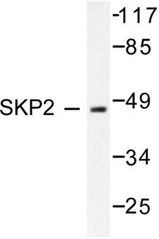 SKP2 Antibody - Western blot of SKP2/p45 (P399) pAb in extracts from 293 cells.