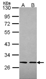 SLA Antibody - Sample (30 ug of whole cell lysate). A:293T, B: A431 . 12% SDS PAGE. SLMAP / SLAP antibody diluted at 1:2000.
