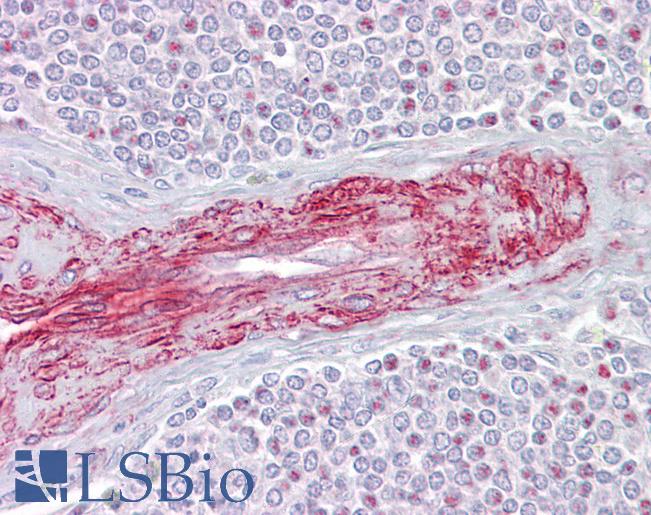 SLA Antibody - Anti-SLA antibody IHC of human spleen. Immunohistochemistry of formalin-fixed, paraffin-embedded tissue after heat-induced antigen retrieval. Antibody concentration 5 ug/ml.  This image was taken for the unconjugated form of this product. Other forms have not been tested.