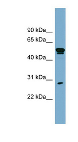 SLA Antibody - SLA antibody Western blot of OVCAR-3 cell lysate. This image was taken for the unconjugated form of this product. Other forms have not been tested.