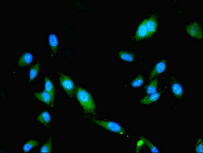 SLA Antibody - Immunofluorescent analysis of Hela cells using SLA Antibody at dilution of 1:100 and Alexa Fluor 488-congugated AffiniPure Goat Anti-Rabbit IgG(H+L)