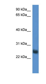 SLA2 / SLAP2 Antibody - SLA2 antibody Western blot of HepG2 cell lysate.  This image was taken for the unconjugated form of this product. Other forms have not been tested.