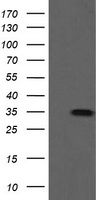 SLA2 / SLAP2 Antibody - HEK293T cells were transfected with the pCMV6-ENTRY control (Left lane) or pCMV6-ENTRY SLA2 (Right lane) cDNA for 48 hrs and lysed. Equivalent amounts of cell lysates (5 ug per lane) were separated by SDS-PAGE and immunoblotted with anti-SLA2.