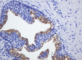 SLA2 / SLAP2 Antibody - IHC of paraffin-embedded Human prostate tissue using anti-SLA2 mouse monoclonal antibody.