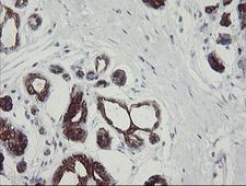 SLA2 / SLAP2 Antibody - IHC of paraffin-embedded Human breast tissue using anti-SLA2 mouse monoclonal antibody.
