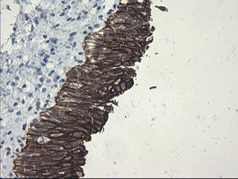 SLA2 / SLAP2 Antibody - IHC of paraffin-embedded Human bladder tissue using anti-SLA2 mouse monoclonal antibody.