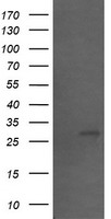 SLA2 / SLAP2 Antibody - HEK293T cells were transfected with the pCMV6-ENTRY control (Left lane) or pCMV6-ENTRY SLA2 (Right lane) cDNA for 48 hrs and lysed. Equivalent amounts of cell lysates (5 ug per lane) were separated by SDS-PAGE and immunoblotted with anti-SLA2.