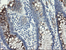 SLA2 / SLAP2 Antibody - IHC of paraffin-embedded Human colon tissue using anti-SLA2 mouse monoclonal antibody.