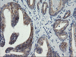 SLA2 / SLAP2 Antibody - IHC of paraffin-embedded Human prostate tissue using anti-SLA2 mouse monoclonal antibody.