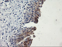 SLA2 / SLAP2 Antibody - IHC of paraffin-embedded Human bladder tissue using anti-SLA2 mouse monoclonal antibody.