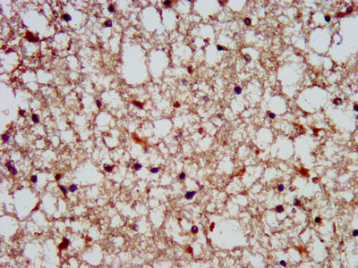 SLAIN1 Antibody - Immunohistochemistry image at a dilution of 1:300 and staining in paraffin-embedded human brain tissue performed on a Leica BondTM system.