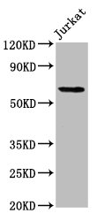 SLAIN1 Antibody - Positive Western Blot detected in Jurkat whole cell lysate. All lanes: SLAIN1 antibody at 4.2 µg/ml Secondary Goat polyclonal to rabbit IgG at 1/50000 dilution. Predicted band size: 61 KDa. Observed band size: 61 KDa