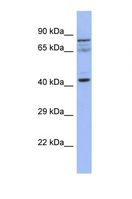 SLAIN2 Antibody - Western blot of Human HepG2. SLAIN2 antibody dilution 1.0 ug/ml.  This image was taken for the unconjugated form of this product. Other forms have not been tested.