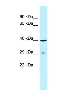 SLAMF1 / SLAM / CD150 Antibody - SLAMF1 / SLAM / CD150 antibody western blot of 721_B Cell lysate. Antibody concentration 1 ug/ml.  This image was taken for the unconjugated form of this product. Other forms have not been tested.