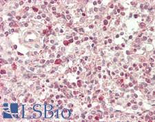 SLAMF1 / SLAM / CD150 Antibody - Human Spleen: Formalin-Fixed, Paraffin-Embedded (FFPE)
