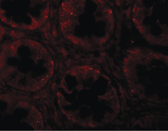 SLAMF1 / SLAM / CD150 Antibody - Immunofluorescence of SLAMF1 in human colon tissue with SLAMF1 antibody at 20 ug/ml.