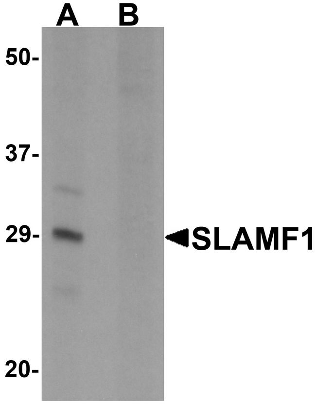 SLAMF1 / SLAM / CD150 Antibody - Western blot analysis of SLAMF1 in rat colon tissue lysate with SLAMF1 antibody at 1 ug/ml in (A) the absence and (B) the presence of blocking peptide.