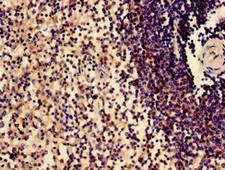 SLAMF1 / SLAM / CD150 Antibody - Immunohistochemistry of paraffin-embedded human spleen tissue using SLAMF1 Antibody at dilution of 1:100