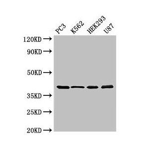 SLAMF1 / SLAM / CD150 Antibody - Western Blot Positive WB detected in: PC-3 whole cell lysate, MCF-7 whole cell lysate, K562 whole cell lysate, HEK293 whole cell lysate, U87 whole cell lysate All lanes: SLAMF1 antibody at 3µg/ml Secondary Goat polyclonal to rabbit IgG at 1/50000 dilution Predicted band size: 38, 34, 41 kDa Observed band size: 38 kDa