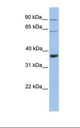 SLAMF6 / NTBA Antibody - Fetal heart lysate. Antibody concentration: 1.0 ug/ml. Gel concentration: 12%.  This image was taken for the unconjugated form of this product. Other forms have not been tested.