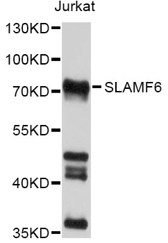 SLAMF6 / NTBA Antibody - Western blot analysis of extracts of Jurkat cells, using SLAMF6 antibody at 1:1000 dilution. The secondary antibody used was an HRP Goat Anti-Rabbit IgG (H+L) at 1:10000 dilution. Lysates were loaded 25ug per lane and 3% nonfat dry milk in TBST was used for blocking. An ECL Kit was used for detection and the exposure time was 15s.