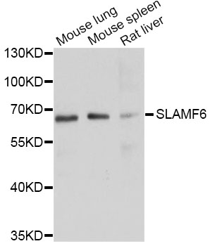 SLAMF6 / NTBA Antibody - Western blot analysis of extracts of various cell lines, using SLAMF6 antibodyat 1:1000 dilution. The secondary antibody used was an HRP Goat Anti-Rabbit IgG (H+L) at 1:10000 dilution. Lysates were loaded 25ug per lane and 3% nonfat dry milk in TBST was used for blocking. An ECL Kit was used for detection and the exposure time was 10s.